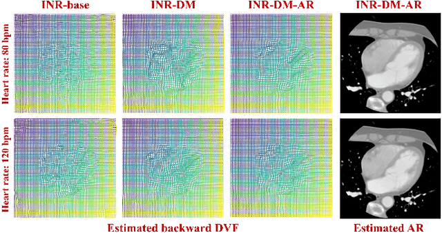 Figure 4 for Nonperiodic dynamic CT reconstruction using backward-warping INR with regularization of diffeomorphism (BIRD)