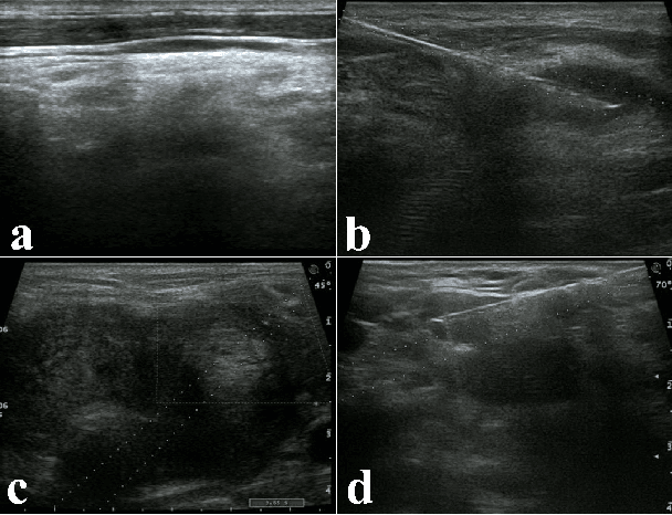 Figure 1 for US-SFNet: A Spatial-Frequency Domain-based Multi-branch Network for Cervical Lymph Node Lesions Diagnoses in Ultrasound Images