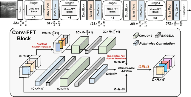 Figure 3 for US-SFNet: A Spatial-Frequency Domain-based Multi-branch Network for Cervical Lymph Node Lesions Diagnoses in Ultrasound Images