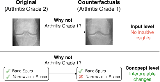Figure 1 for Climbing the Ladder of Interpretability with Counterfactual Concept Bottleneck Models