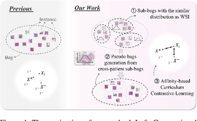 Figure 1 for Cross-Patient Pseudo Bags Generation and Curriculum Contrastive Learning for Imbalanced Multiclassification of Whole Slide Image