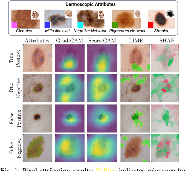Figure 1 for Are Explanations Helpful? A Comparative Analysis of Explainability Methods in Skin Lesion Classifiers