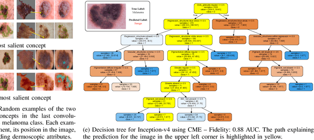 Figure 2 for Are Explanations Helpful? A Comparative Analysis of Explainability Methods in Skin Lesion Classifiers