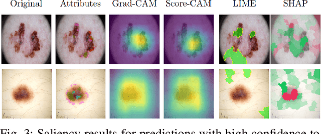 Figure 3 for Are Explanations Helpful? A Comparative Analysis of Explainability Methods in Skin Lesion Classifiers