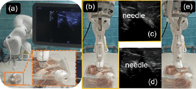 Figure 1 for Needle Segmentation Using GAN: Restoring Thin Instrument Visibility in Robotic Ultrasound