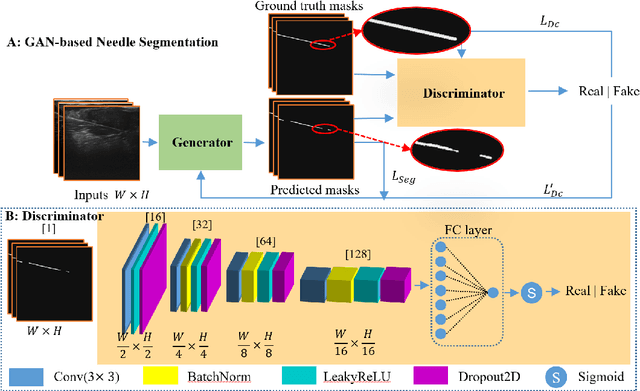 Figure 2 for Needle Segmentation Using GAN: Restoring Thin Instrument Visibility in Robotic Ultrasound