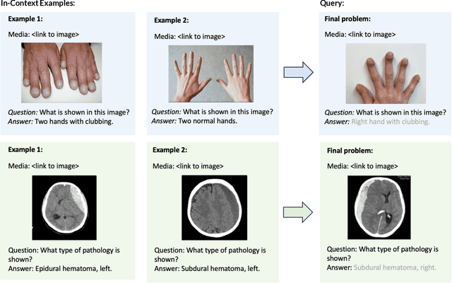 Figure 1 for SMMILE: An Expert-Driven Benchmark for Multimodal Medical In-Context Learning