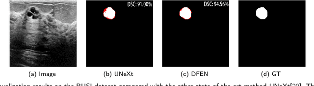Figure 1 for DFEN: Dual Feature Equalization Network for Medical Image Segmentation