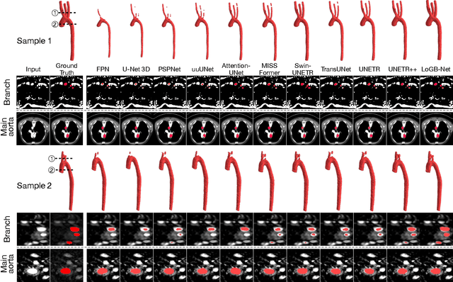 Figure 3 for AI-Powered Automated Model Construction for Patient-Specific CFD Simulations of Aortic Flows