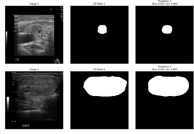 Figure 4 for A Deep Learning Framework for Thyroid Nodule Segmentation and Malignancy Classification from Ultrasound Images