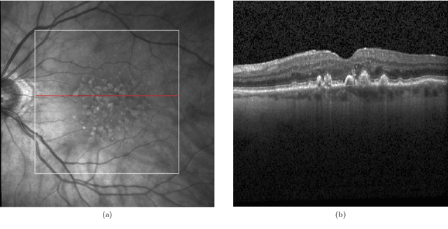 Figure 3 for Modular Deep Active Learning Framework for Image Annotation: A Technical Report for the Ophthalmo-AI Project