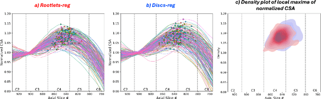 Figure 3 for Rootlets-based registration to the spinal cord PAM50 template