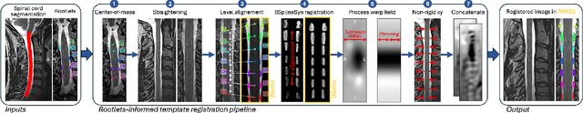 Figure 1 for Rootlets-based registration to the spinal cord PAM50 template