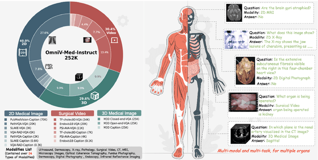 Figure 3 for OmniV-Med: Scaling Medical Vision-Language Model for Universal Visual Understanding