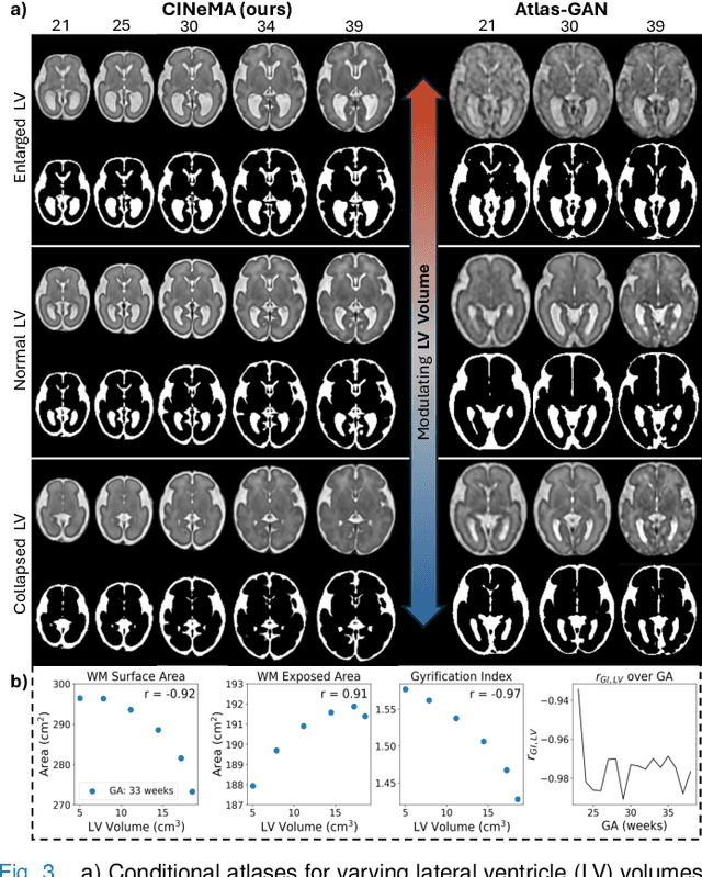 Figure 4 for CINeMA: Conditional Implicit Neural Multi-Modal Atlas for a Spatio-Temporal Representation of the Perinatal Brain