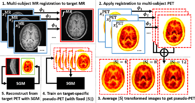 Figure 1 for Multi-Subject Image Synthesis as a Generative Prior for Single-Subject PET Image Reconstruction