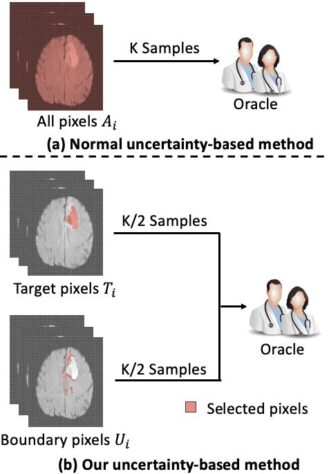 Figure 1 for Breaking the Barrier: Selective Uncertainty-based Active Learning for Medical Image Segmentation