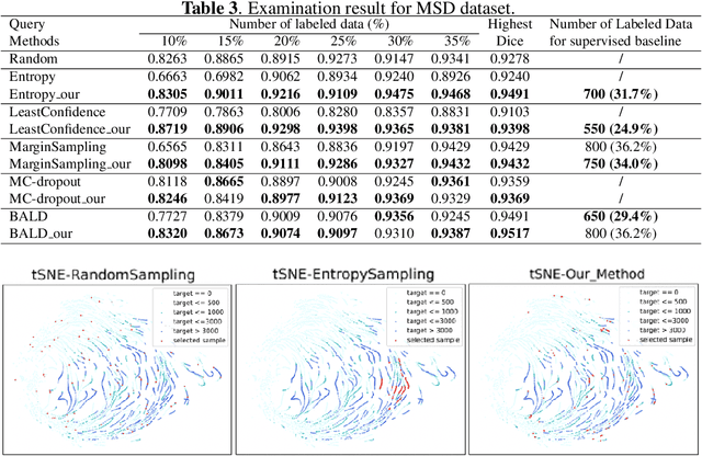 Figure 4 for Breaking the Barrier: Selective Uncertainty-based Active Learning for Medical Image Segmentation