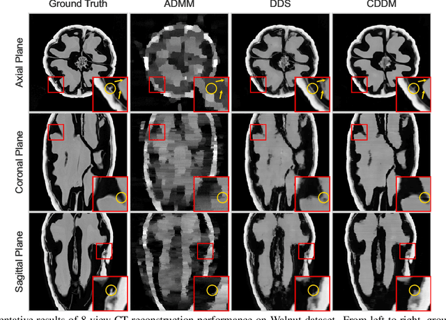 Figure 4 for Mitigating Data Consistency Induced Discrepancy in Cascaded Diffusion Models for Sparse-view CT Reconstruction