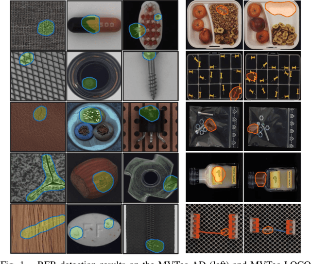 Figure 1 for REB: Reducing Biases in Representation for Industrial Anomaly Detection