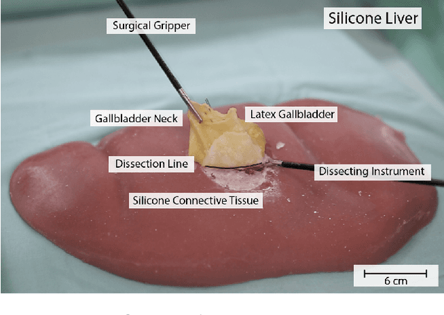 Figure 1 for Interactive Surgical Liver Phantom for Cholecystectomy Training