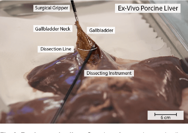 Figure 2 for Interactive Surgical Liver Phantom for Cholecystectomy Training