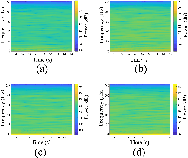 Figure 2 for Upper Limb Movement Execution Classification using Electroencephalography for Brain Computer Interface