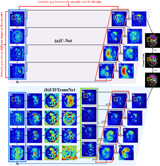 Figure 3 for Narrowing the semantic gaps in U-Net with learnable skip connections: The case of medical image segmentation