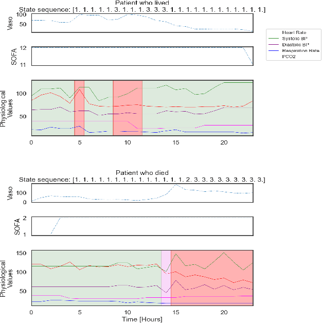 Figure 2 for A Knowledge Distillation Approach for Sepsis Outcome Prediction from Multivariate Clinical Time Series