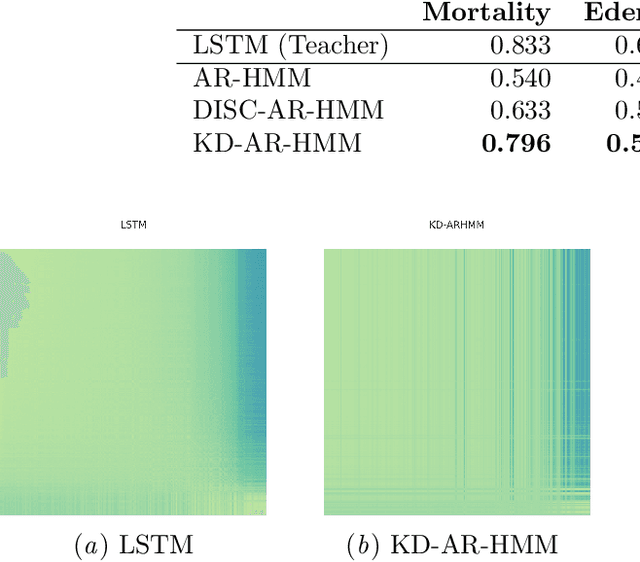 Figure 3 for A Knowledge Distillation Approach for Sepsis Outcome Prediction from Multivariate Clinical Time Series