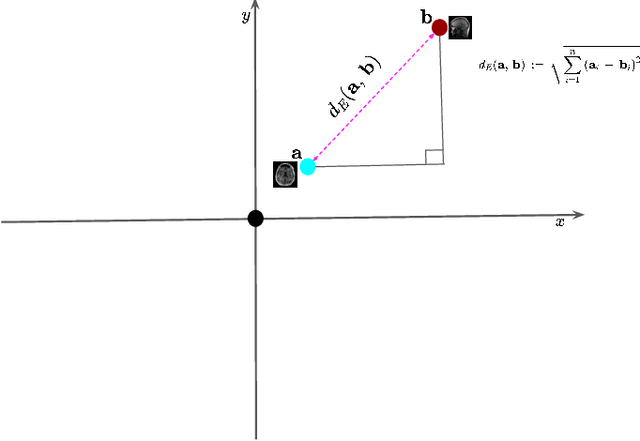 Figure 4 for Advancing Low-Rank and Local Low-Rank Matrix Approximation in Medical Imaging: A Systematic Literature Review and Future Directions