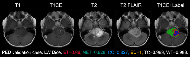 Figure 3 for Magnetic Resonance Imaging Feature-Based Subtyping and Model Ensemble for Enhanced Brain Tumor Segmentation