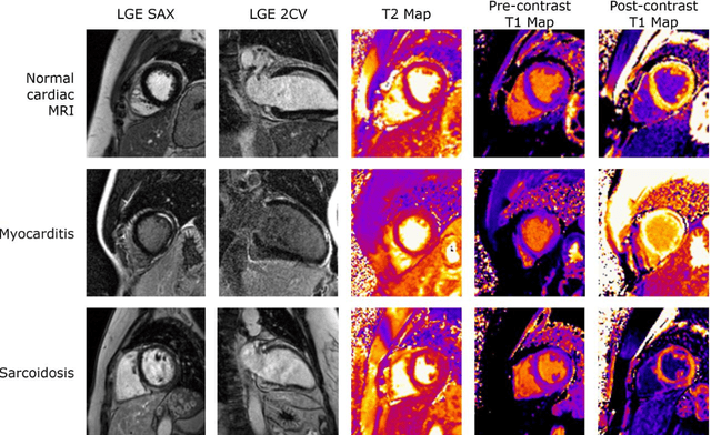 Figure 2 for Deep learning-based segmentation of T1 and T2 cardiac MRI maps for automated disease detection
