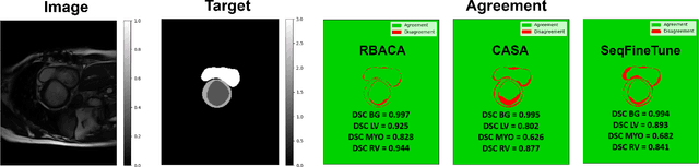 Figure 3 for Continual Deep Active Learning for Medical Imaging: Replay-Base Architecture for Context Adaptation