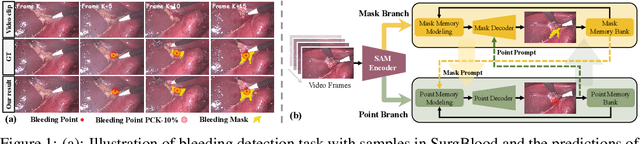 Figure 1 for Synergistic Bleeding Region and Point Detection in Surgical Videos