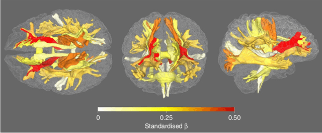 Figure 3 for Bayesian Dynamic DAG Learning: Application in Discovering Dynamic Effective Connectome of Brain