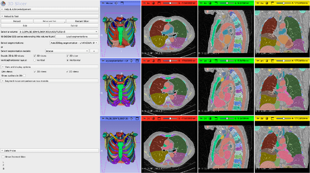Figure 4 for In search of truth: Evaluating concordance of AI-based anatomy segmentation models