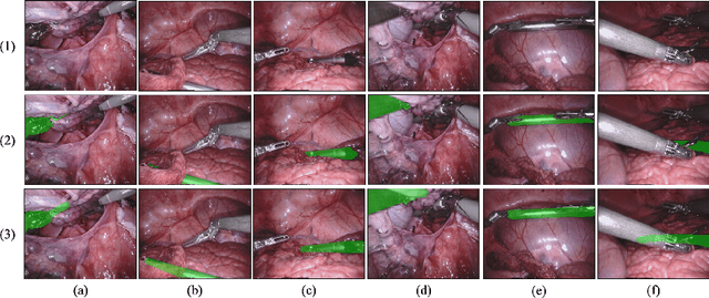 Figure 1 for Amodal Segmentation for Laparoscopic Surgery Video Instruments