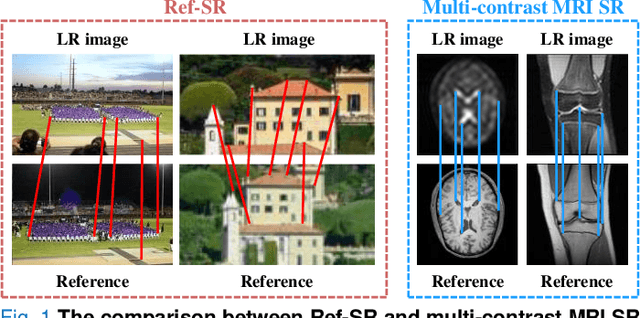 Figure 1 for Compound Attention and Neighbor Matching Network for Multi-contrast MRI Super-resolution