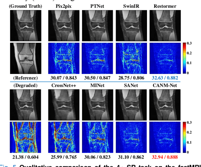 Figure 4 for Compound Attention and Neighbor Matching Network for Multi-contrast MRI Super-resolution