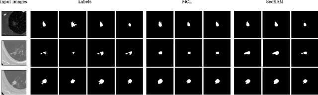 Figure 3 for SeqSAM: Autoregressive Multiple Hypothesis Prediction for Medical Image Segmentation using SAM