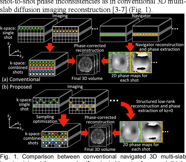 Figure 1 for Self-navigated 3D diffusion MRI using an optimized CAIPI sampling and structured low-rank reconstruction