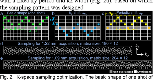 Figure 4 for Self-navigated 3D diffusion MRI using an optimized CAIPI sampling and structured low-rank reconstruction