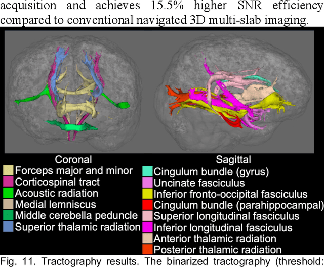 Figure 3 for Self-navigated 3D diffusion MRI using an optimized CAIPI sampling and structured low-rank reconstruction