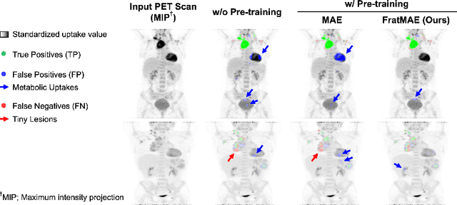 Figure 4 for Developing a PET/CT Foundation Model for Cross-Modal Anatomical and Functional Imaging