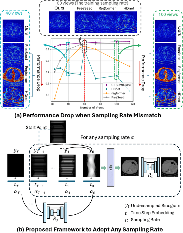Figure 1 for CT-SDM: A Sampling Diffusion Model for Sparse-View CT Reconstruction across All Sampling Rates