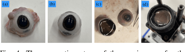 Figure 4 for Towards Motion Compensation in Autonomous Robotic Subretinal Injections
