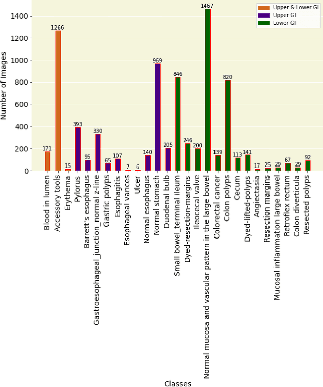 Figure 3 for GastroVision: A Multi-class Endoscopy Image Dataset for Computer Aided Gastrointestinal Disease Detection