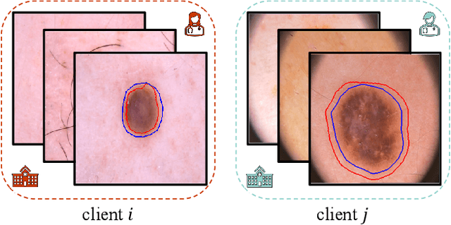 Figure 1 for FedA3I: Annotation Quality-Aware Aggregation for Federated Medical Image Segmentation Against Heterogeneous Annotation Noise
