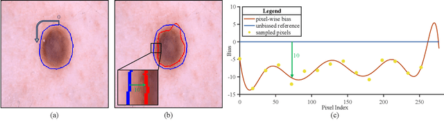 Figure 3 for FedA3I: Annotation Quality-Aware Aggregation for Federated Medical Image Segmentation Against Heterogeneous Annotation Noise